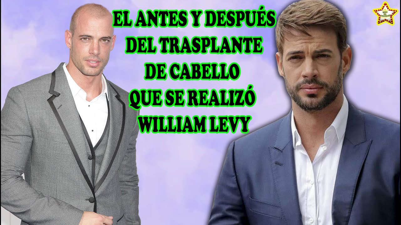 william levy calvo y con pelo