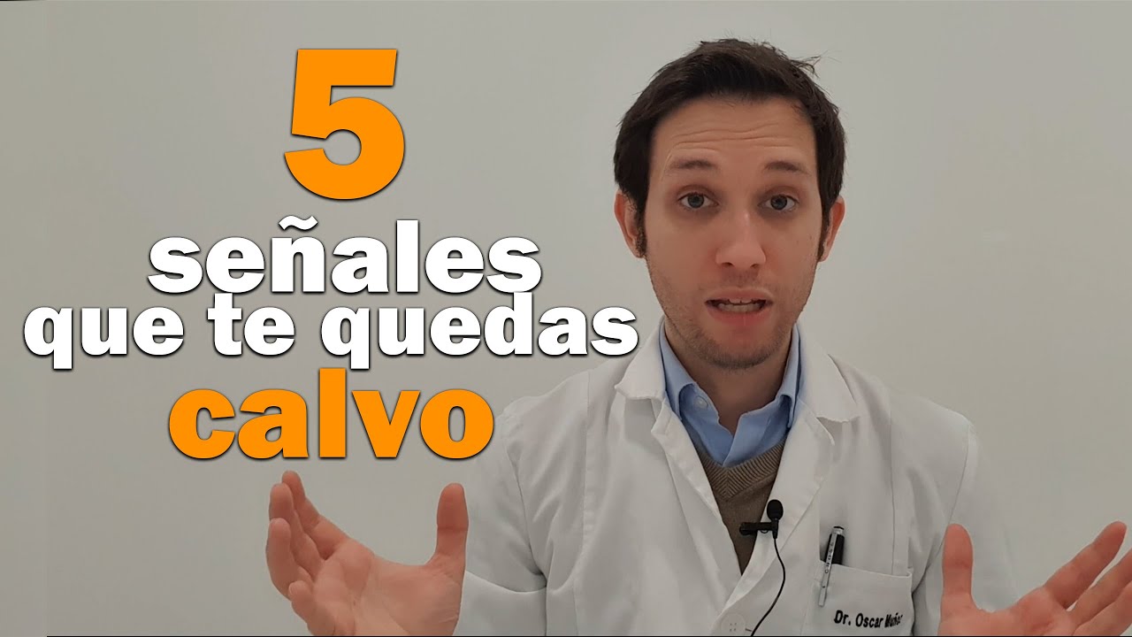 calvo a partir de los 40