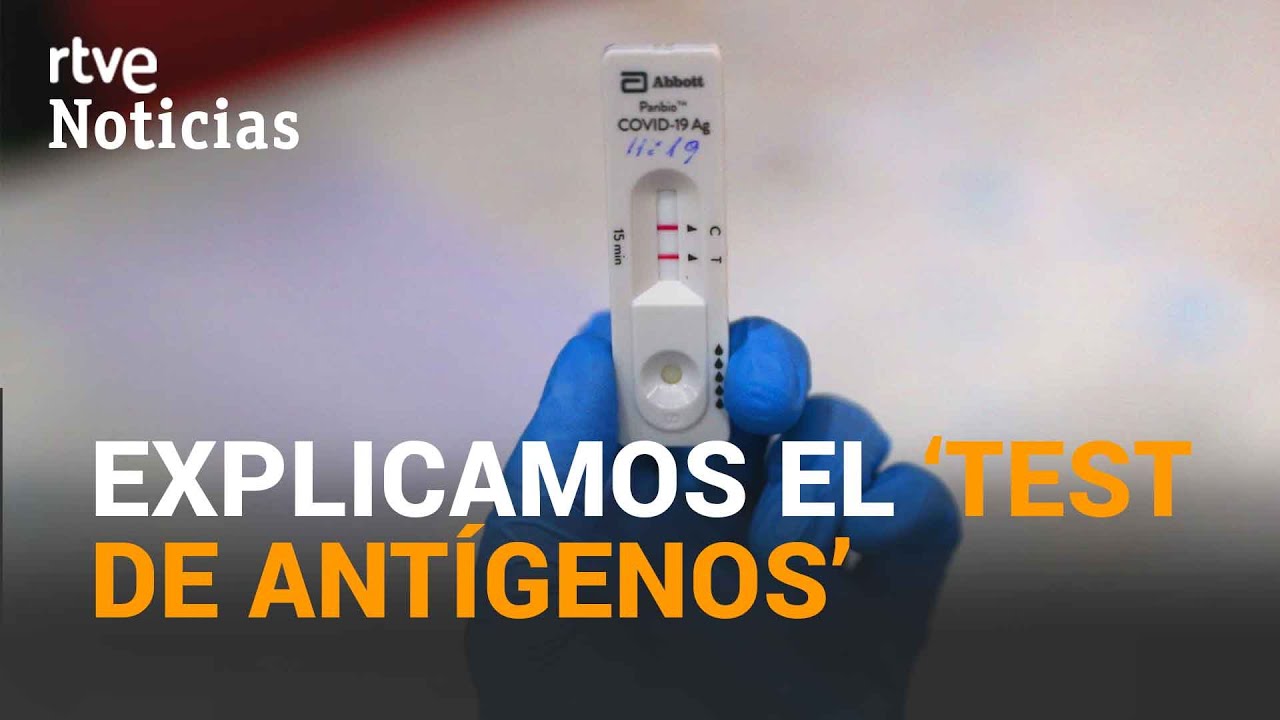 cuanto cuesta un test de antigenos